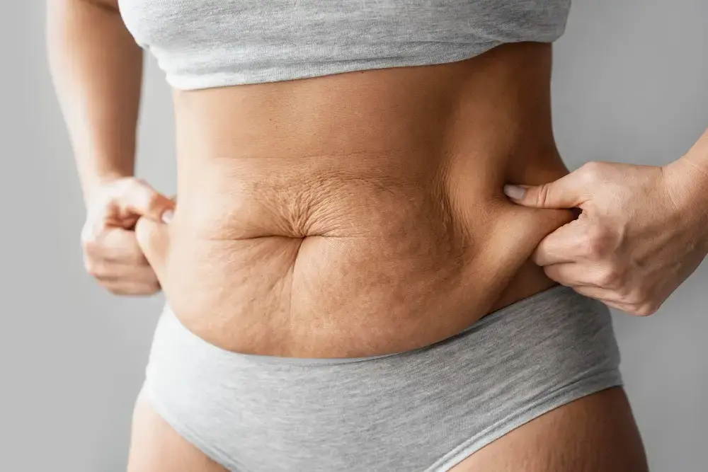 white female holding her stomach fat